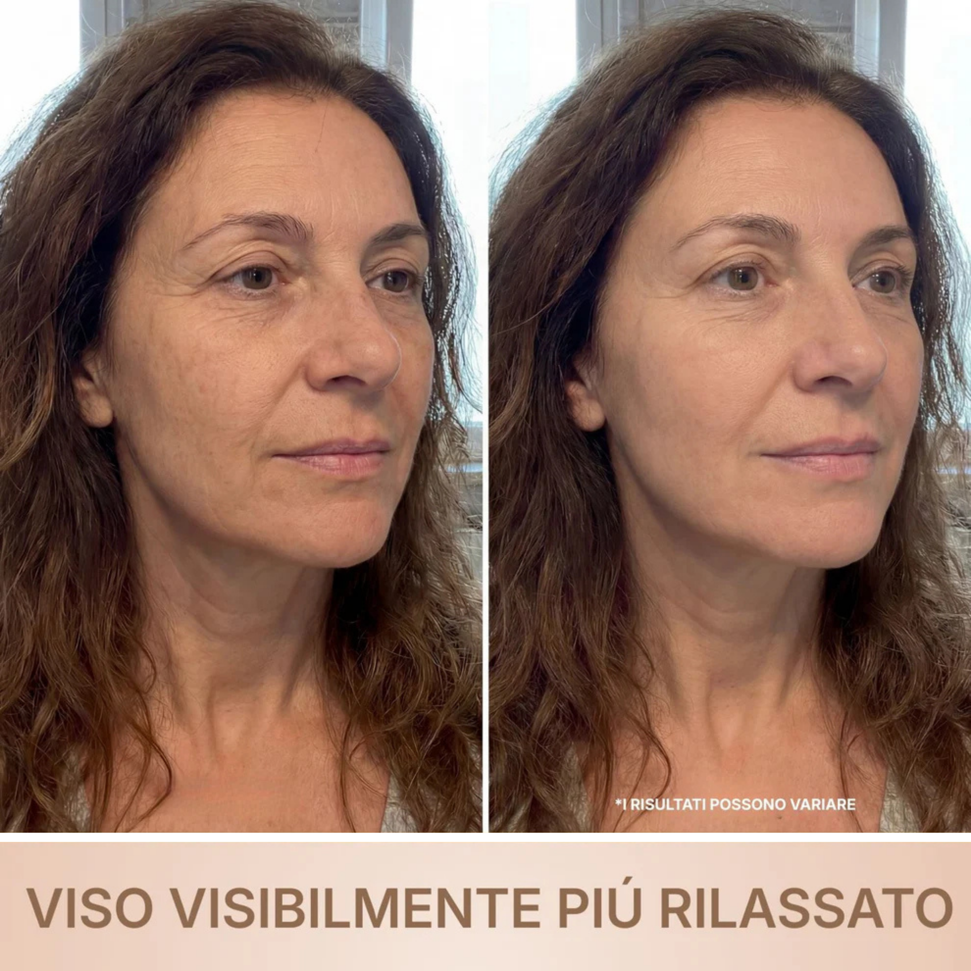 Sericora • Siero Coreano Effetto Lifting dalla Prima Applicazione