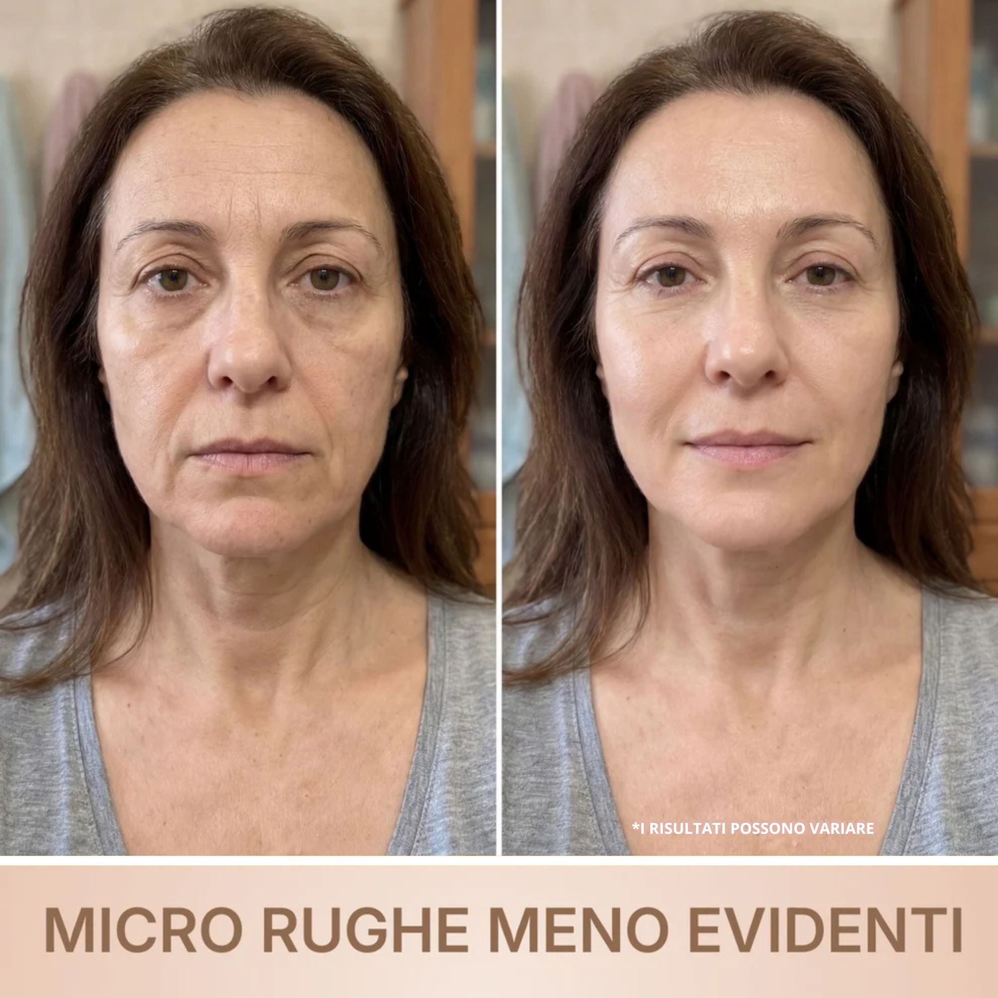 Sericora • Siero Coreano Effetto Lifting dalla Prima Applicazione